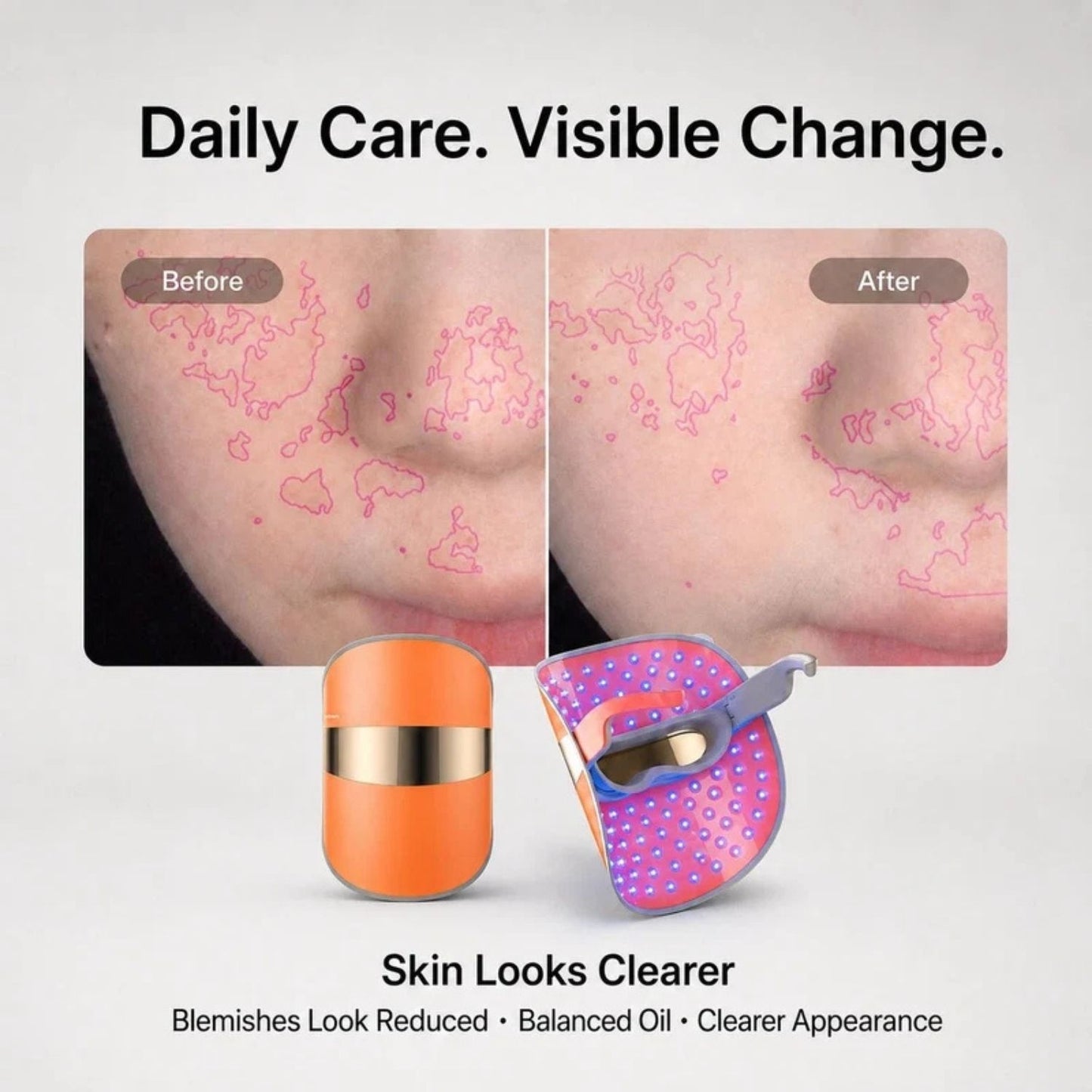 TouchBeauty LED Face Mask with Red Blue Yellow Light Therapy
